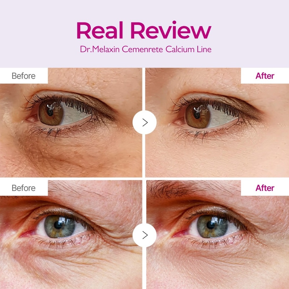 Dr Melaxin Cemenrete Calcium Volume Eye Patches - BRAND NEW & SEALED - Picture 7 of 7